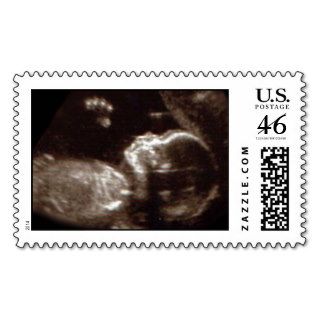 Baby Ultrasound Postage Stamps