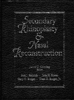 Secondary Rhinoplasty and Nasal Reconstruction (9780942219807): Rod J. Rohrich, Jack H. Sheen, James C. Grotting, Gary Burget: Books