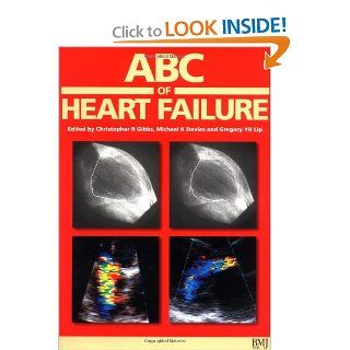 ABC of Heart Failure: Christopher R. Gibbs, Michael K. Davies, Gregory Y. H. Lip: 9780727914576: Books