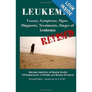Leukemia: Causes, Symptoms, Signs, Diagnosis, Treatments, Stages of Leukemia   Revised Edition   Illustrated by S. Smith: Department of Health and Human Services, National Institutes of Health, National Cancer Institute, S. Smith: 9781470016715: Books