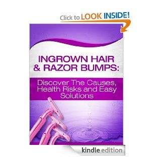 Ingrown Hair & Razor Bumps: Discover The Causes, Health Risks and Easy Solutions   Kindle edition by Gone Dreaming. Health, Fitness & Dieting Kindle eBooks @ .