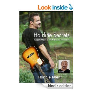 Hairline Secrets: Male Pattern Hair Loss   what works (and what doesn't) eBook: Ronnie Talent: Kindle Store