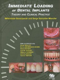 Immediate Loading of Dental Implants: Theory and Clinical Practice: 9782912550507: Medicine & Health Science Books @