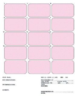 #2421 ECG Mounting Sheets with Patient Information   8.5x11 Portrait, 3 Column, 15 Lead Segments (Box of 100 Mounts) Health & Personal Care